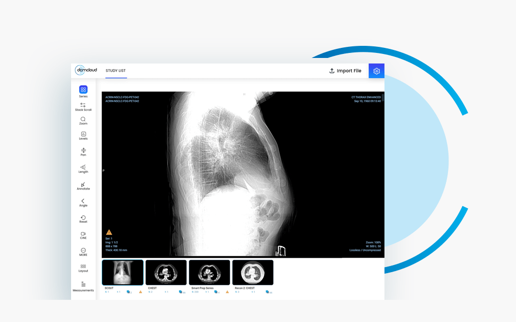 You are currently viewing WEB BASED DICOM VIEWER WITHOUT THE PACS: DCMCLOUD